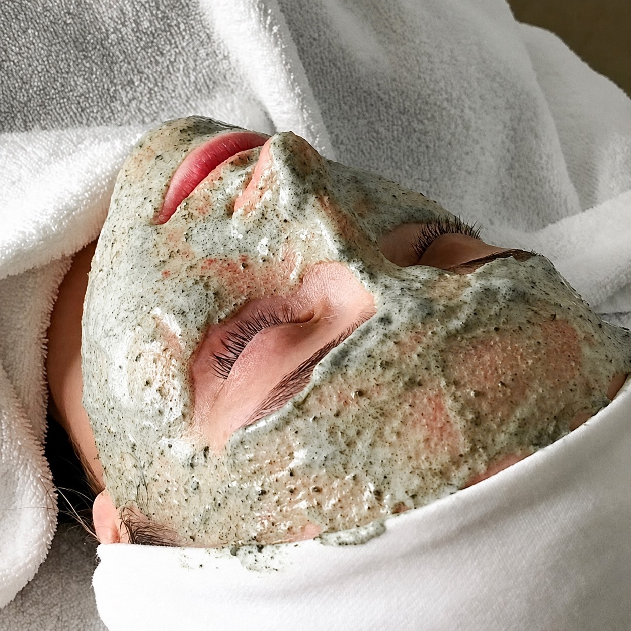 Green-Peel-Kräuterschälkur: Gesicht mit aufgetragener Kräutermaske