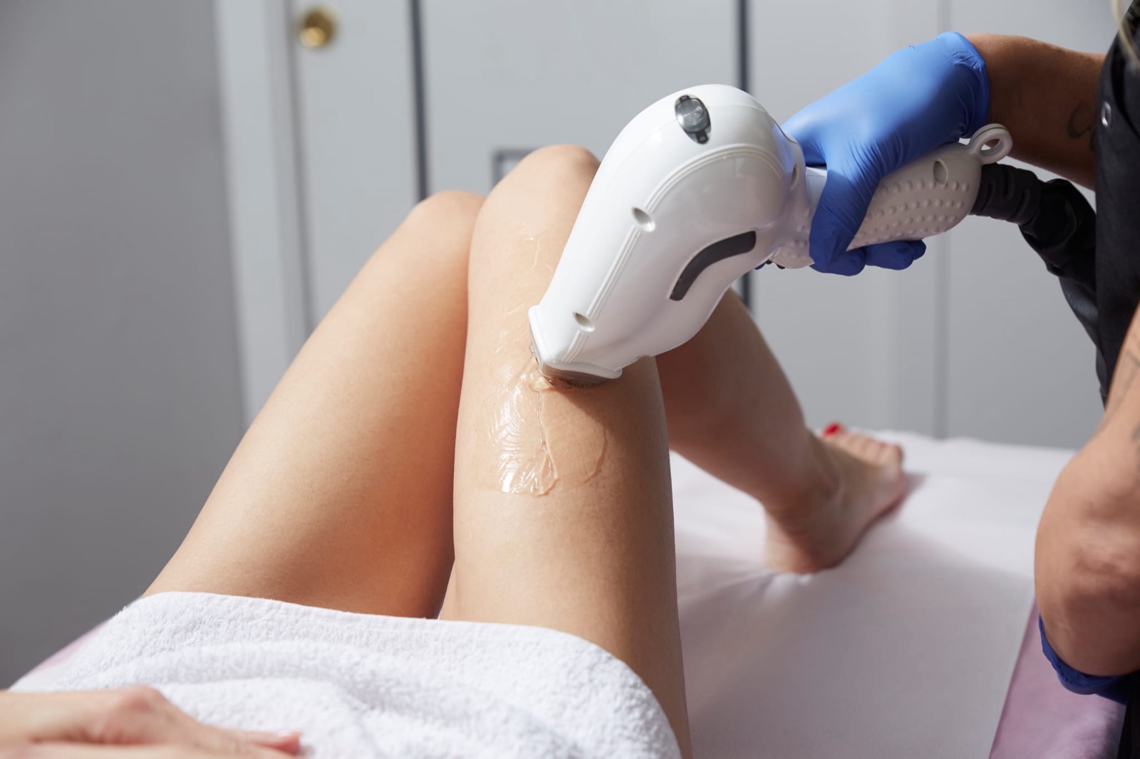 Dauerhafte Haarentfernung: Diodenlaser-Behandlung an den Beinen